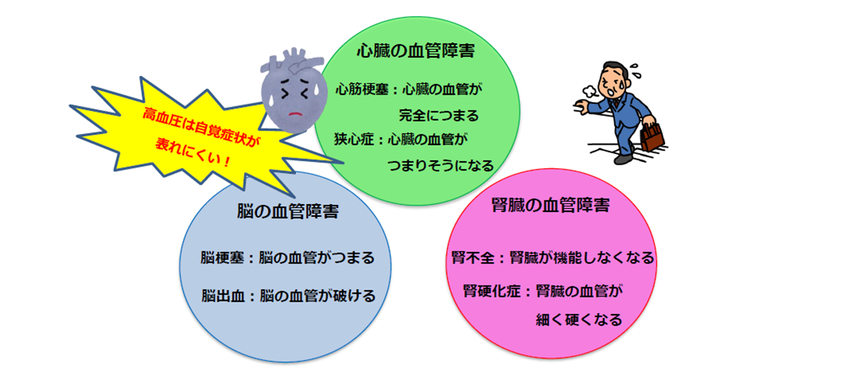イラスト：高血圧の症状