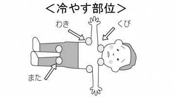 イラスト：冷やす部位　くび、わき、またの図示
