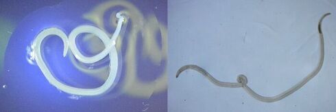 アニサキス虫体の写真