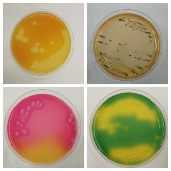4つの食中毒細菌の培地の写真